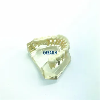 Зъбни импланти, протези, модел на моста за имплантиране на зъби на долната челюст, комуникационна модел на дентална клиника Typodont