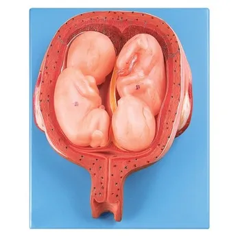 Пятимесячная модел близнаци, развитие на плода, гинеколог показва имитационную модел в реален размер безплатна доставка