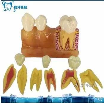 Четири пъти зъби се разлагат модел на зъба се обяснява пульпу и анатомията на модели на устната кухина